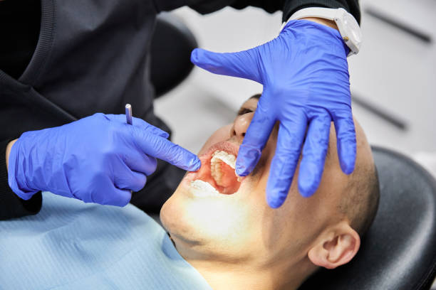Best Emergency Dental Filling Replacement  in Six Mile Run, NJ