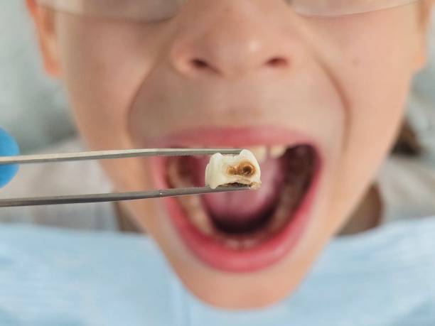 Best Knocked-Out Tooth Emergency  in Six Mile Run, NJ